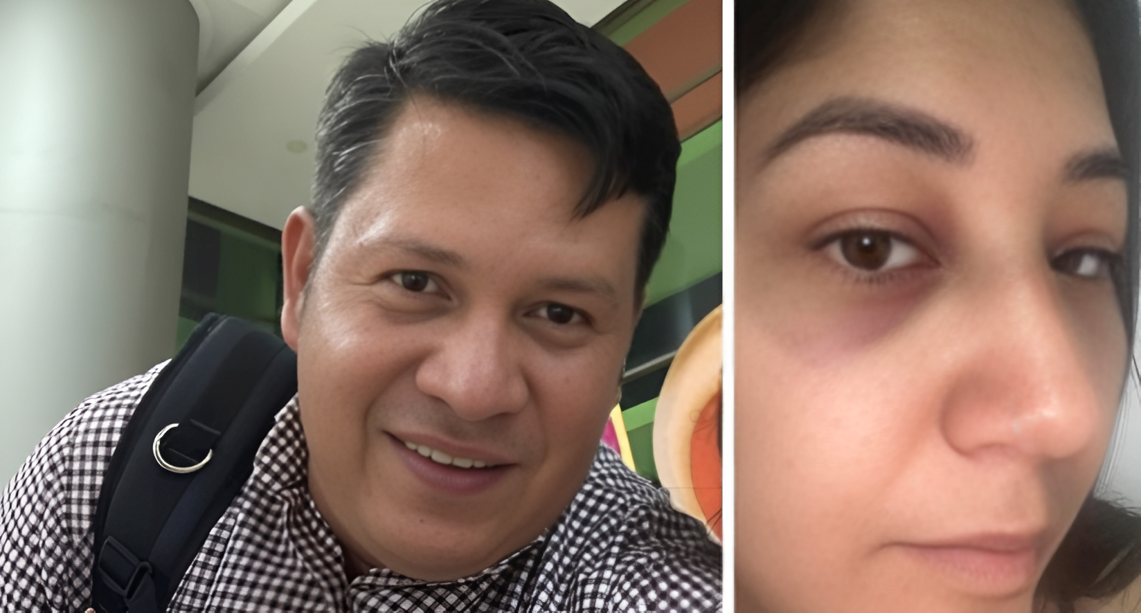 Funcionario acusado de agresión