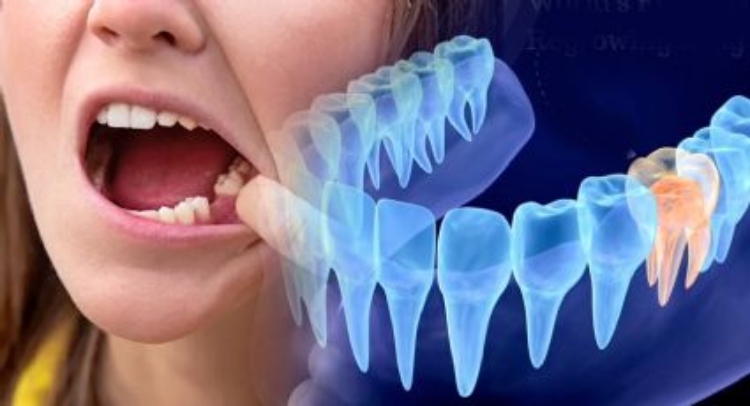 Científicos en Japón descubren células madre que forman raíces dentales