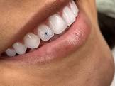 Nicolás Quintero Barbosa impulsa en Colombia la tendencia de decoración dental, una opción estética juvenil que personaliza la sonrisa.