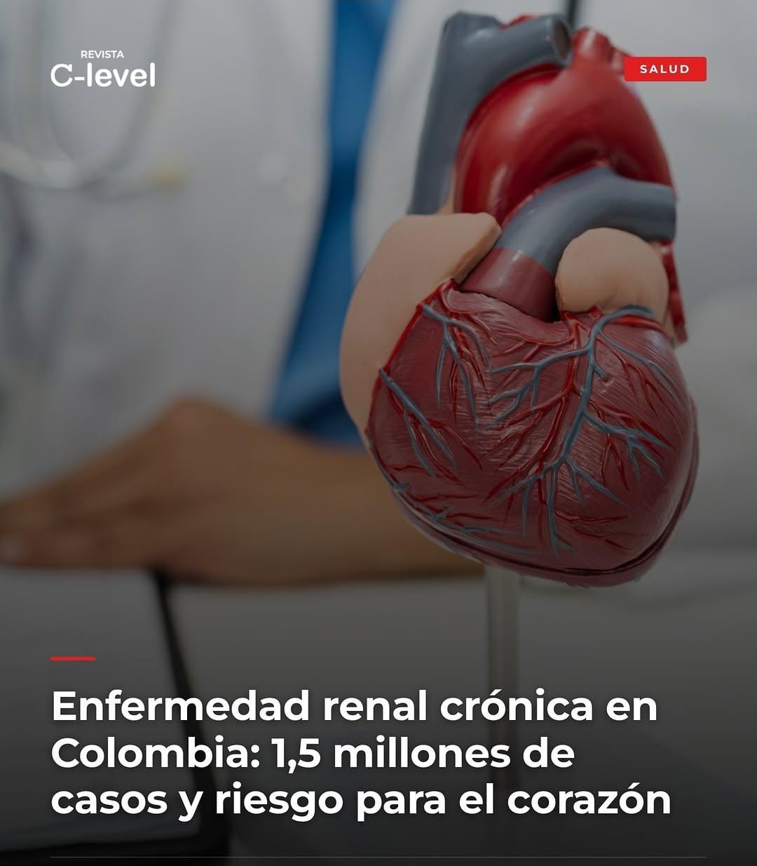 Más de 1,5 millones de colombianos viven con enfermedad renal: llaman a reforzar la prevención