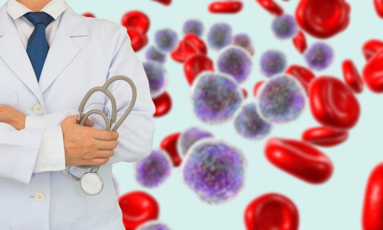 ¿Qué es la leucemia mieloide aguda? la primera con más casos nuevos cada año